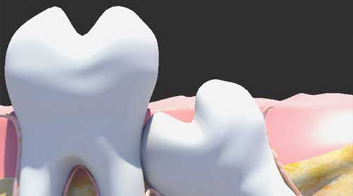 Oral Surgery