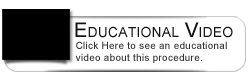 Dental Education Video - Causes of a Root Canal